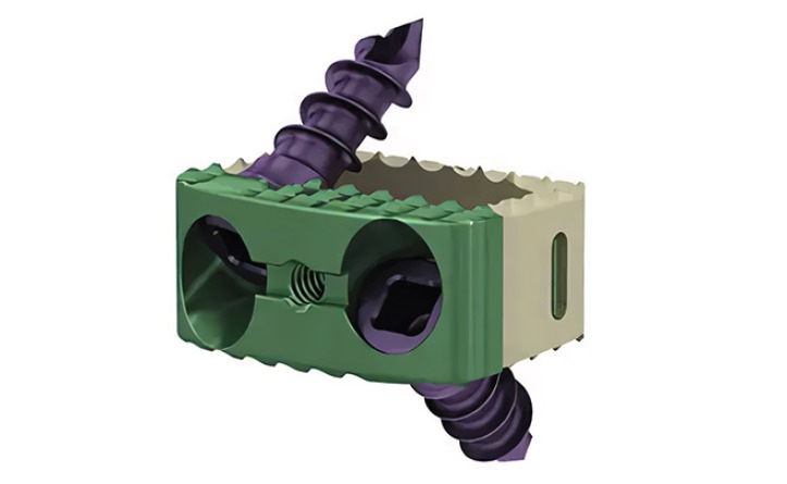 Кейдж для шийного віддлу хребта 7мм (Peek-Титан) Jinlu